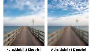 Dioptrien Was Der Dpt Wert Bedeutet Apollo