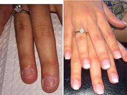Before After Natural Wedding Nails Acrylic Gel Natural Wedding Nails Wedding Nails Nature Wedding