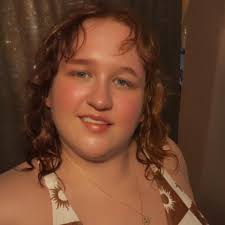 What are some tips for post wisdom teeth surgery?