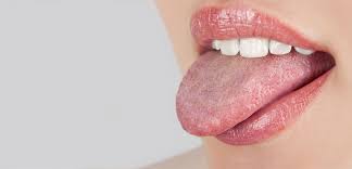 Candida albicans candidoza cauze simptome diagnostic si tratament. Candidoza BucalÄƒ Cauze Diagnostic Tratamente Medicale È™i Naturiste