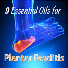 Pin On Essential Oils