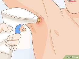 We did not find results for: 3 Simple Ways To Get Rid Of Boil Scars Wikihow