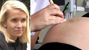 Födelsevrålet får årets RFSU-pris