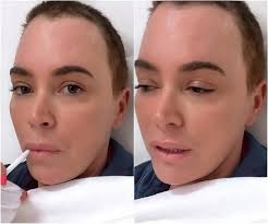 Teddi Mellencamp Hospitalized for Brain Tumors After Severe Headaches!  Reality star Teddi Mellencamp shares her emotional journey after doctors  discovered multiple brain tumors. After weeks of debilitating headaches,  she undergoes surgery to