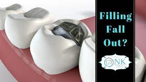 Filling Fall Out How To Handle A Lost Filling We Blogged Recently About How To Handle Accidental Tooth Loss But What Tooth Filling Dental Fillings Filling