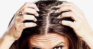 Ecco come trattarli e quali utilizzare per una chioma sana, purificata e luminosa. Capelli Grassi A Causa Del Sebo Cause Rischi E Rimedi Ai Capelli Unti