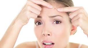 Cara menghilangkan jerawat batu dengan menggunakan jeruk nipis adalah cara paling efektif. 3 Cara Menghilangkan Jerawat Batu Bernanah Dan Beruntusan