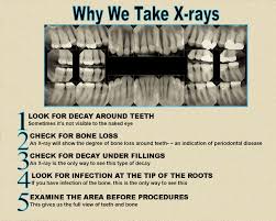 We did not find results for: Why We Take Dental X Rays Smile Sarasota