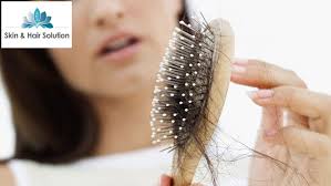 Mesotherapy treatment for hair loss mesotherapy treatment for hair loss. Mesotherapy Hair Loss Treatment Gosawa Beirut Deal