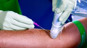 Image result for IV Access