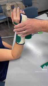 Image result for Ulnar Gutter Splint