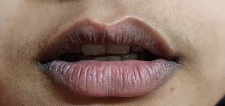 If you smoke then you must have noticed that the colour of your lips is turning dark. Why Are My Lips Black Quora