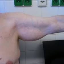 Name of muscles in upper arm. Muscles Of The Upper Arm Doccheck Flexikon