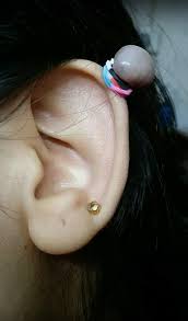 I ve not seen keloid after an eyebrow tattoo myself but it can. Diy Removal Of Skin Blemishes Puts People At Risk Of Death Express Digest
