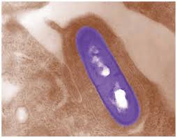 The aim of this study was to characterize the subtype and virulence potential of these l. Listeria A Survivor Sigma Aldrich