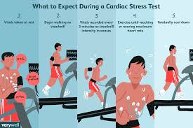 cardiac stress test uses side effects procedure results