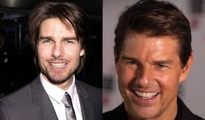 Tom cruise middle tooth has been the about this right front tooth. Celebrities With Braces Before And After Famous Brace Faces