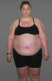 Pin On My Time On Extreme Weight Loss