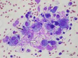 Mesothelioma is an uncommon tumour in dogs, whose diagnosis can be a challenge to the veterinary cytologist. Intrathoracic Myxosarcoma In A Dog Sciencedirect