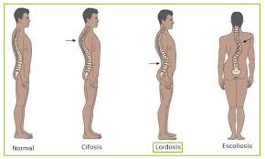 Maybe you would like to learn more about one of these? Rectificacion Cervical Centro De Osteopatia En Barcelona Motec