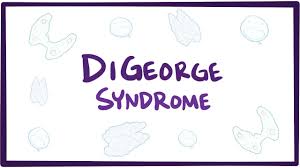22q11 2 Deletion Syndrome Pathophysiology Wikidoc