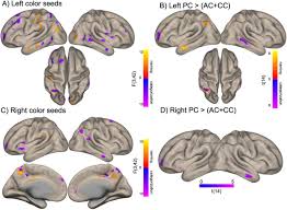 La partie du cerveau post rock noise psyche surfaces lapartieducerveau. Color Naming And Categorization Depend On Distinct Functional Brain Networks Biorxiv