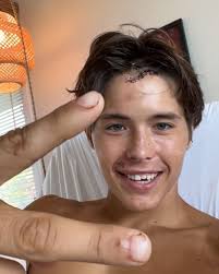 Finally going home after 5 long days and nights in the hospital!!❤️‍🩹🙏  thank you mom and dad for helping me get home so quickly and safely ❤️‍🩹🙏  and thanks to everyone else