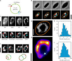 Bacteriology (study of bacteria) is a major part in microbiology.the prokaryotic kingdom consists of unicellular microscopic microorganisms called bacteria. Direct Imaging Of The Circular Chromosome In A Live Bacterium Nature Communications