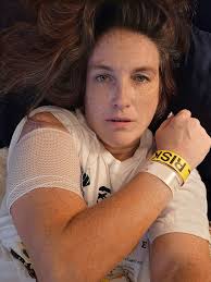 Knee Replacement Surgery and Recovery