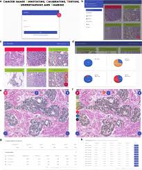 This project is licensed under the terms of the gpl. Cactus Cancer Image Annotating Calibrating Testing Understanding And Sharing In Breast Cancer Histopathology Bmc Research Notes Full Text
