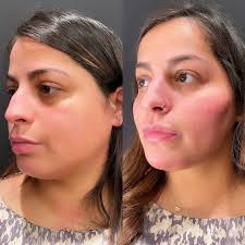 Austin Plastic Surgeon