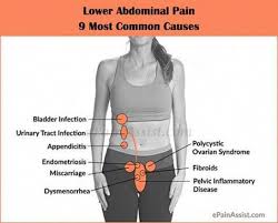Pin On Back Aches