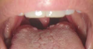 Pin On Medical