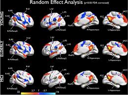 Frontiers Brain Entropy During Aging Through A Free Energy Principle Approach Human Neuroscience