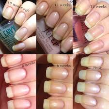 See full list on wikihow.com Everything About My Nail Care Strong Nails Nail Care Routine Healthy Nails