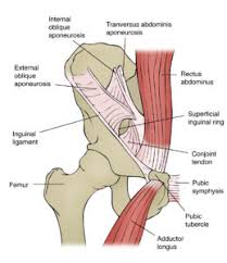 Medically, the groin is the junction between the abdomen and thigh. Osteitis Pubis A Likely Cause Of Groin Pain