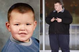 TOSA MAWE: UNENE,KIJANA WA MIAKA 22 MWENYE KILO 139 AFARIKI DUNIA JANA  UINGEREZA SCOTLAND LIAM JOHNSTON PICHA YA UTOTONI NA ALIVYOKUWA MKUBWA