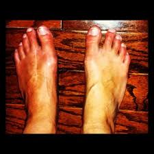 Pin On Crps