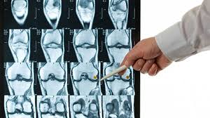 Check spelling or type a new query. Bildgebende Verfahren Wie Funktioniert Ein Mrt Netzathleten De