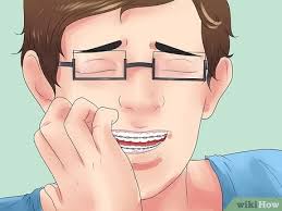 Maybe you would like to learn more about one of these? 5 Ways To Alleviate Orthodontic Brace Pain Wikihow