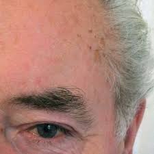 We did not find results for: Pdf Eyebrow Color In Diabetics