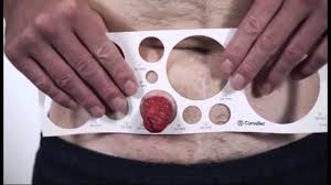 Measuring How To Size Your Stoma