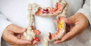 Đại tràng và trực tràng là hai bộ phận đều thuộc ống tiêu hóa và nằm liền kề nhau. Phan Biá»‡t Ung ThÆ° Trá»±c Trang Va Bá»‡nh TrÄ©