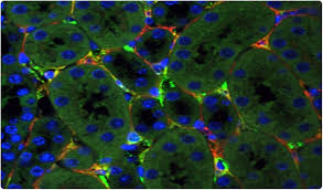Gene Therapy Study Shows Promise For Chronic Kidney Disease