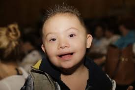 DIF Jalisco se une a celebración del Día Mundial del Síndrome de Down