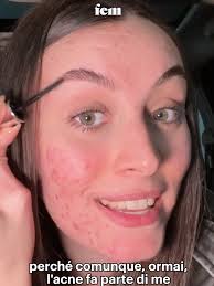 “Mi sento bella nella mia natura imperfetta anche senza make-up perché  comunque ormai l’acne fa parte di me” In questa prima puntata di In between  make-up, il format di Fem in cui una persona sempre ...