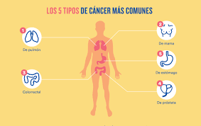 Estoy seguro que muchas personas, que estén leyendo este post en estos momentos. Por Que El Dia Mundial Contra El Cancer Es El 4 De Febrero
