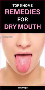 Top 5 Effective Home Remedies To Cure Dry Mouth Remedies For Dry Mouth Dry Mouth Sore In Mouth Remedies