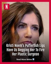 DHS Secretary Kristi Noem has been skewered by social media users (and the  "South Park" writers) for making not-so-subtle changes to her lips'  appearance.