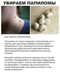 как удалить родинку в домашних условиях за 5 минут Papillomy Rodinki I Borodavki V Lyuboj Moment Mogut Stat Melanomoj Rakom Kozhi Kotoryj Neizlechim Kak Uberech Se Zdorove Zhurnal O Zdorove Zhenskoe Zdorove